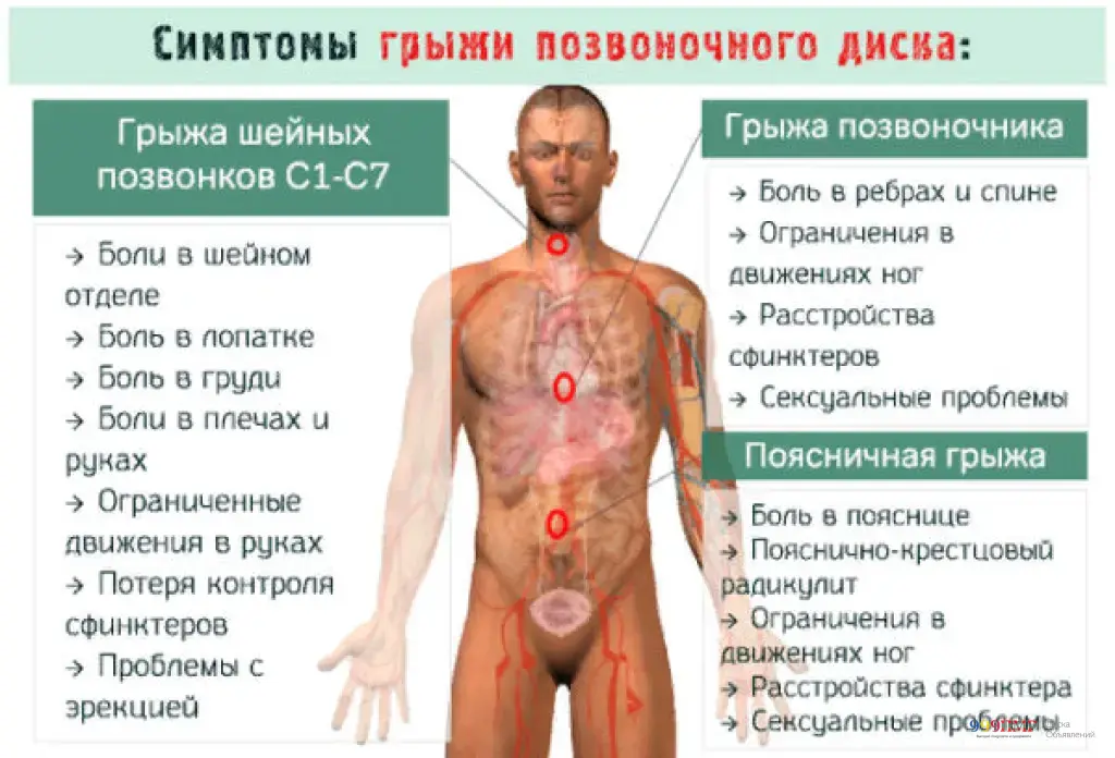 Ортопедический корректор позвоночника