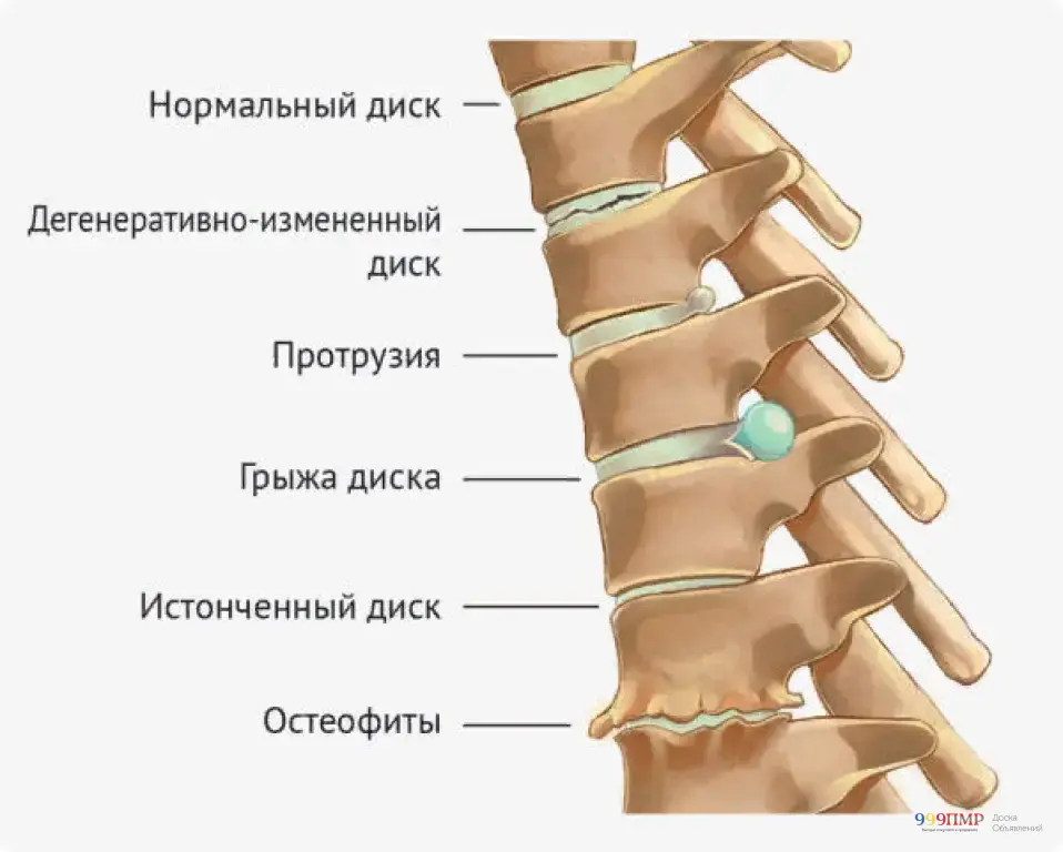 Ортопедический корректор позвоночника